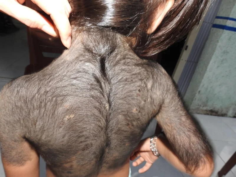 Hình 23 trong bộ l** nhiều lông