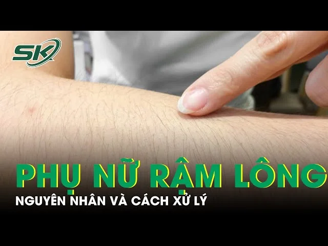 l** nhiều lông — ảnh 30