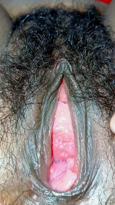 l** nhiều lông (18)