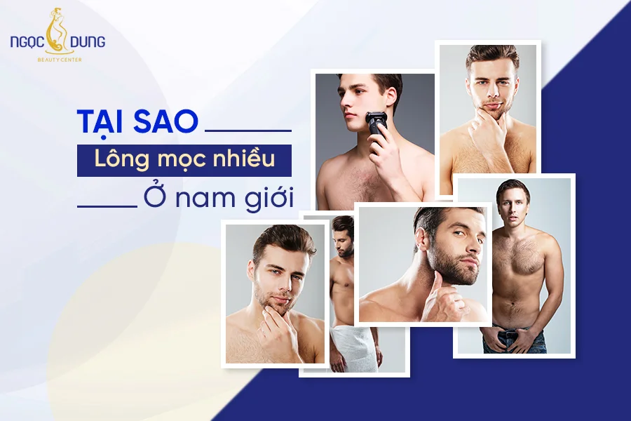 Tại sao lông mọc nhiều ở nam giới? Cách xử lý hiệu quả (2)