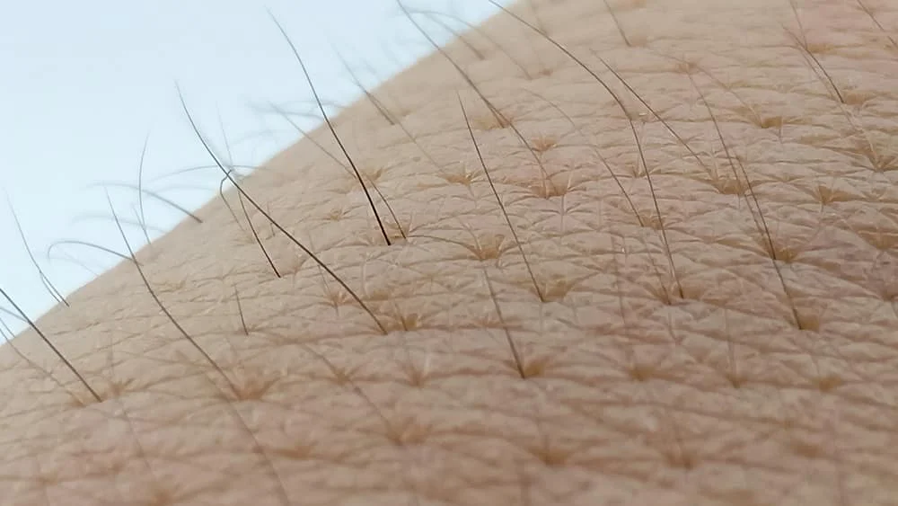 Tại sao con gái lại có nhiều lông chân và cách khắc phục? - YouMed News