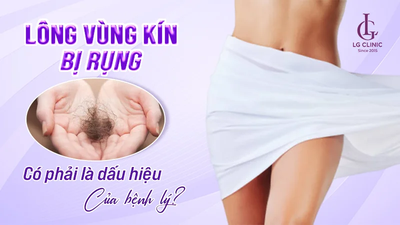 Bộ sưu tập l** nhiều lông — ảnh 11