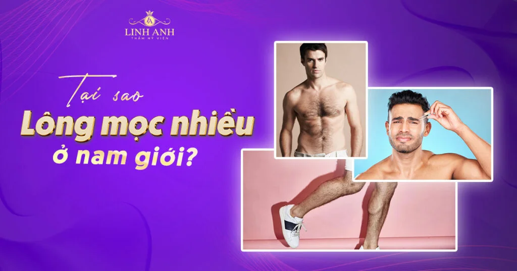 Tại sao lông mọc nhiều ở nam giới? Cách xử lý hiệu quả
