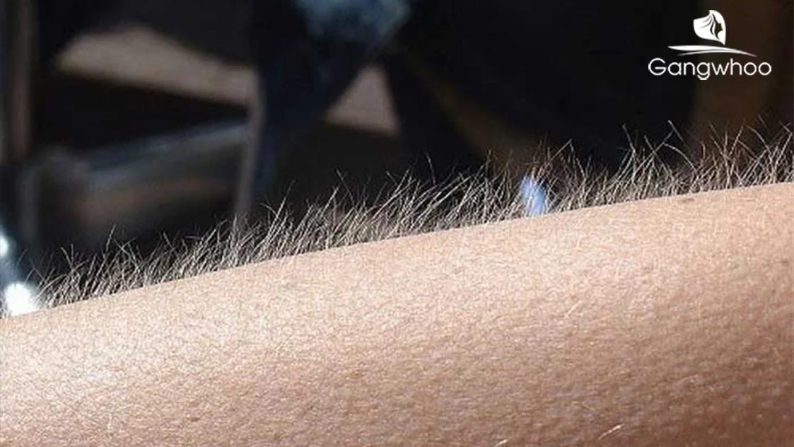 Con Gái Nhiều Lông Tay Lông Chân Thì Sao? Giàu Hay Sinh Lý Cao?