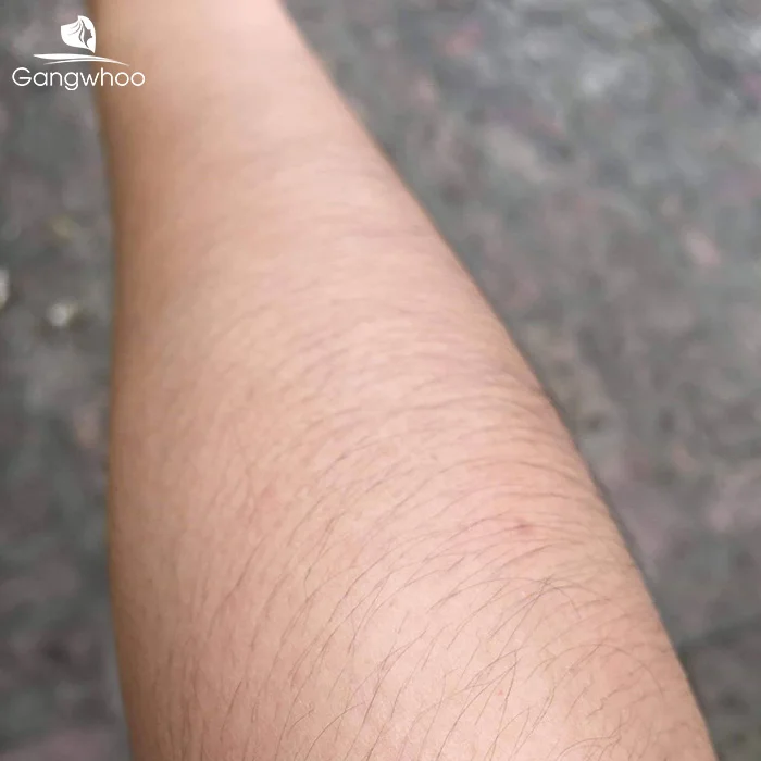 Con Gái Nhiều Lông Tay Lông Chân Thì Sao? Giàu Hay Sinh Lý Cao? (2)